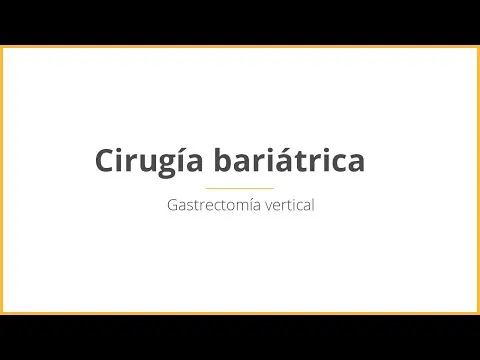 Gastrectomía vertical · Medics Integral Salut