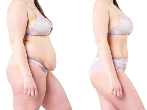 Reducir la barriga en Girona