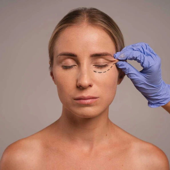 Blefaroplastia en Girona · Medics Integral Salut